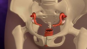 How Hysterectomy Can Affect Menopause Symptoms