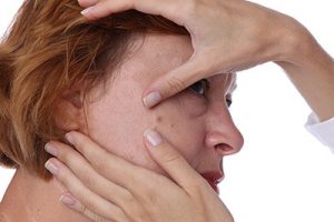 Managing Skin Changes During Menopause 2